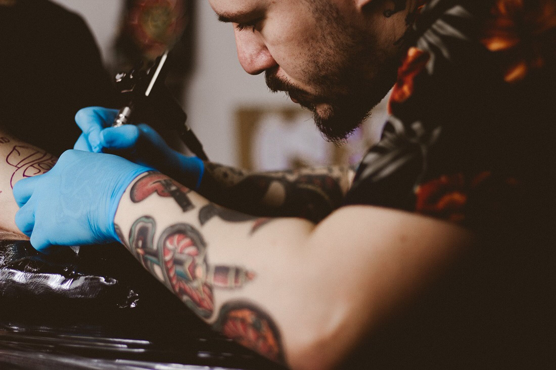 tattoo verwijderen