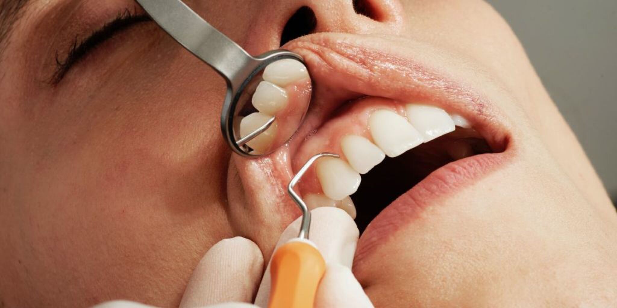 Otrhodontist salaris