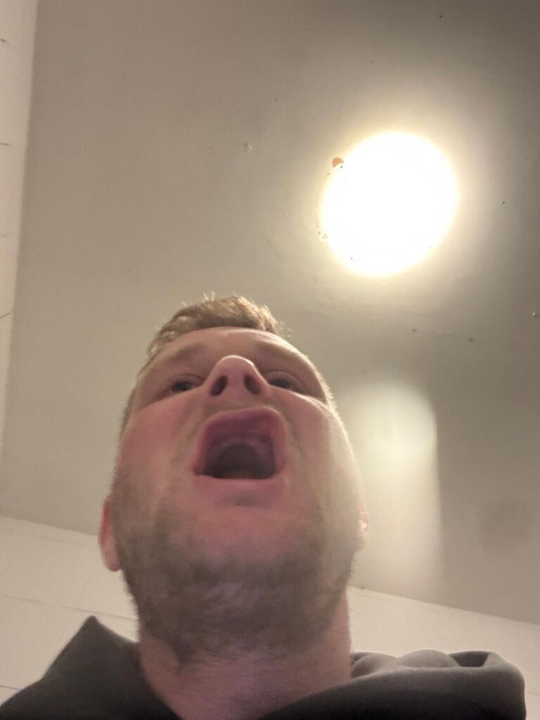 Jon Denton met een selfie waar hij even laat zien dat hij geen tanden meer over heeft.