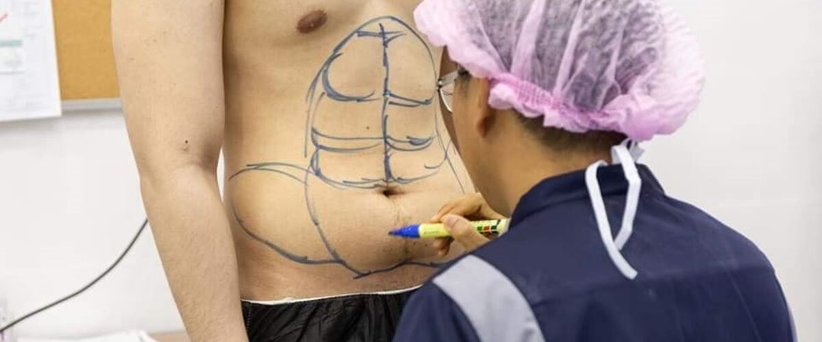 Een permanente sixpack middels implantaten? Het kan in Thailand!