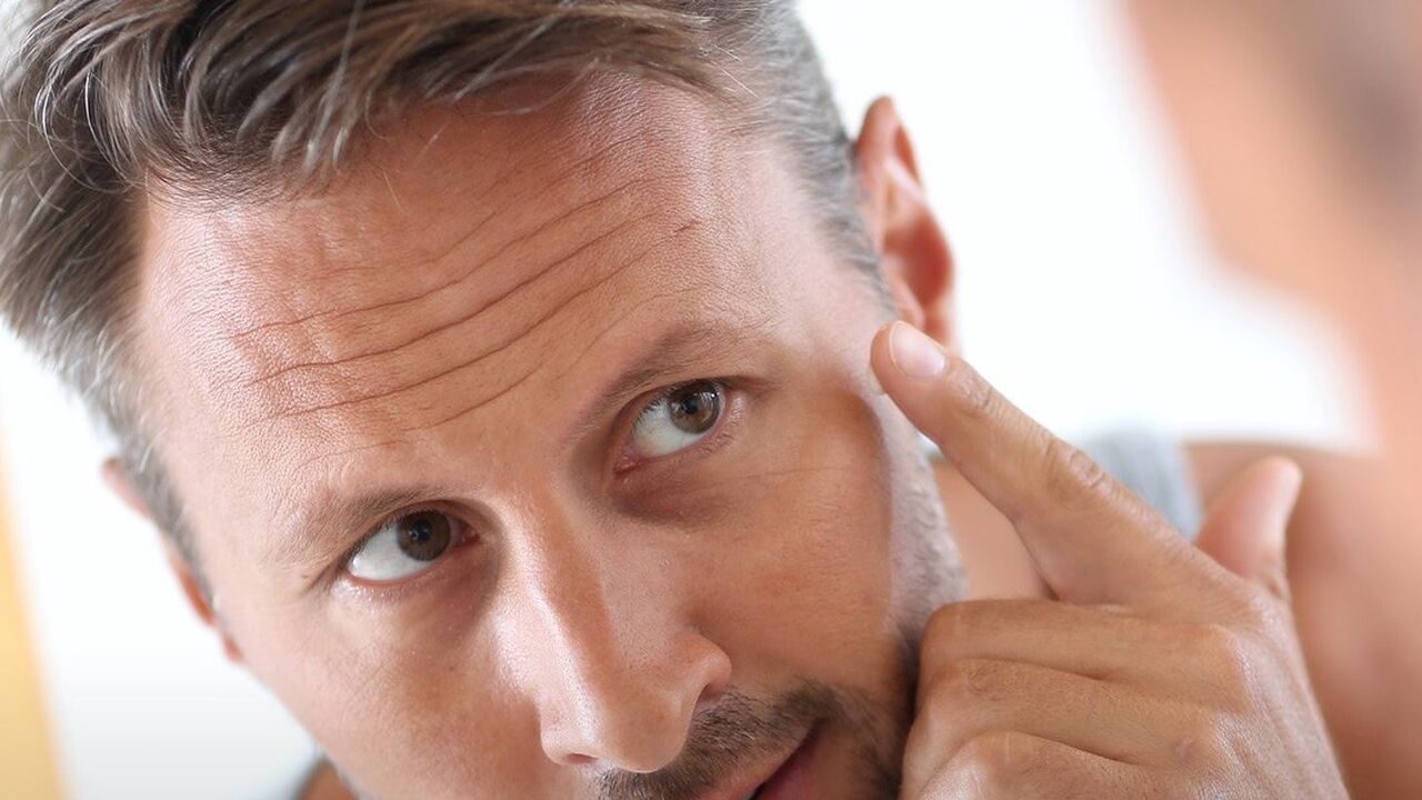 wat doen tegen rimpels voorkomen tegengaan