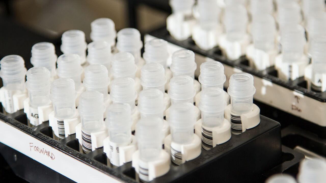 dna test loopt verkeerd af