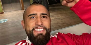 arturo vidal auto