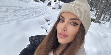 Simi Leskovsk&aacute;