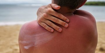 wanneer gebtuik je welke factor zonnebrand spf