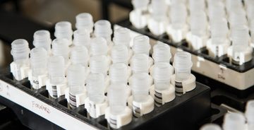 dna test loopt verkeerd af