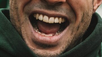 oorzaken van gele tanden