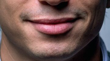 puistje op de lip uitknijpen behandelen voorkomen