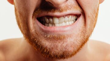 signalen gevolgen te veel suiker eten drinken