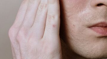 symptomen vitaminetekort