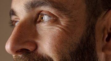 welke lichaamsdelen als eerste rimpels snelste