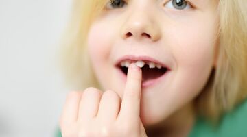 wanneer tanden wisselen