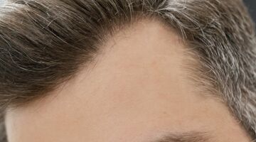 wat is het verschil tussen droog en beschadigd haar