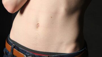 Een buik van iemand die last heeft van een opgeblazen gevoel