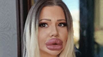 andrea heeft de grootste lippen ter wereld
