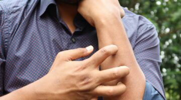 jeukende huid ziekte