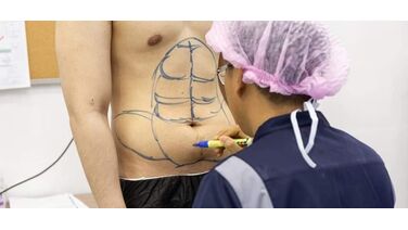 Een permanente sixpack middels implantaten? Het kan in Thailand!