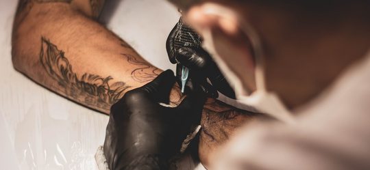 Tattoo verwijderen