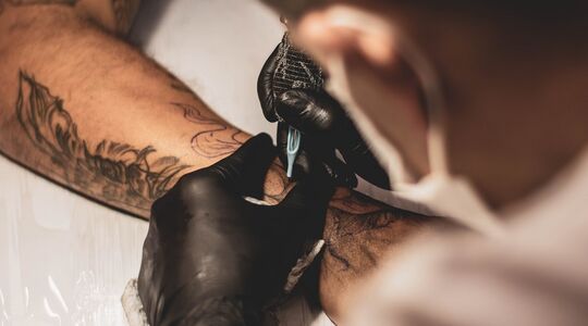 Tattoo verwijderen