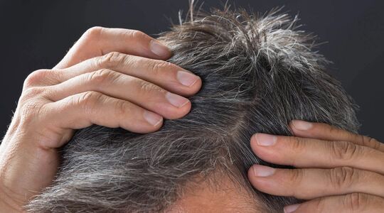 Wetenschappers komen steeds een stap dichterbij een remedie voor grijze haren