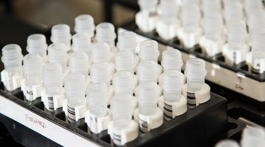 dna test loopt verkeerd af
