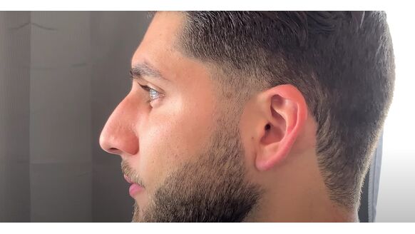 Baard laten overlopen: zo maak je zelf een fade in 5 stappen